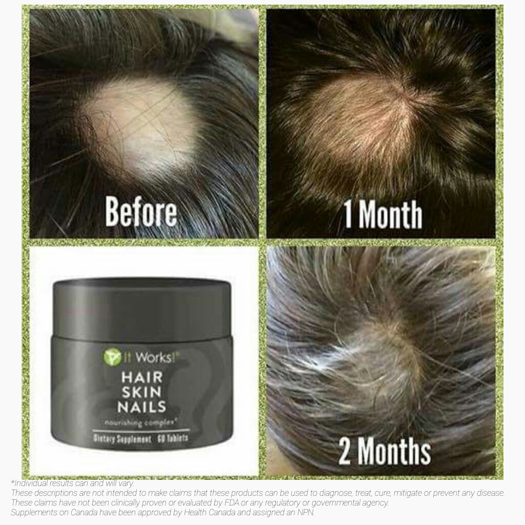 Men Love Our Itworks Hsn Hair Skin Nails Product